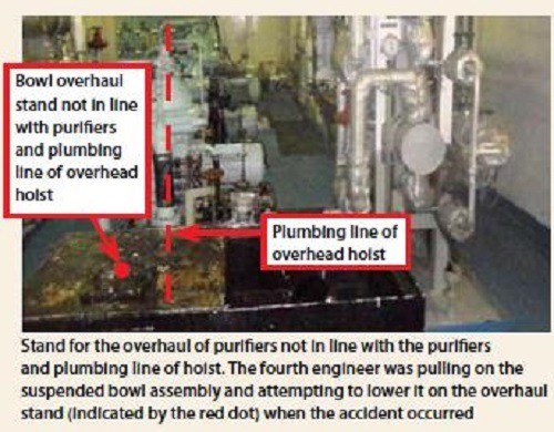 Serious hand injury 1